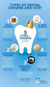 Choosing the Best Cap for Front Teeth Understanding Porcelain Crowns